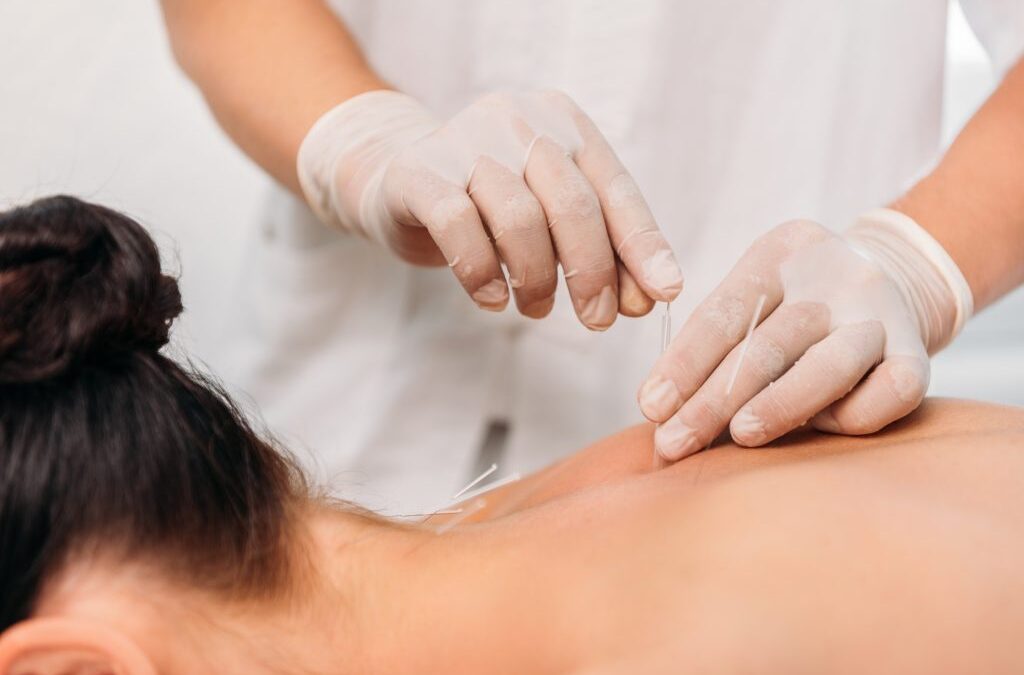 How acupuncture can prick your pain away
