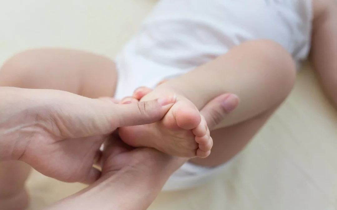 Stepping towards success: the role of physiotherapy in treating Clubfoot