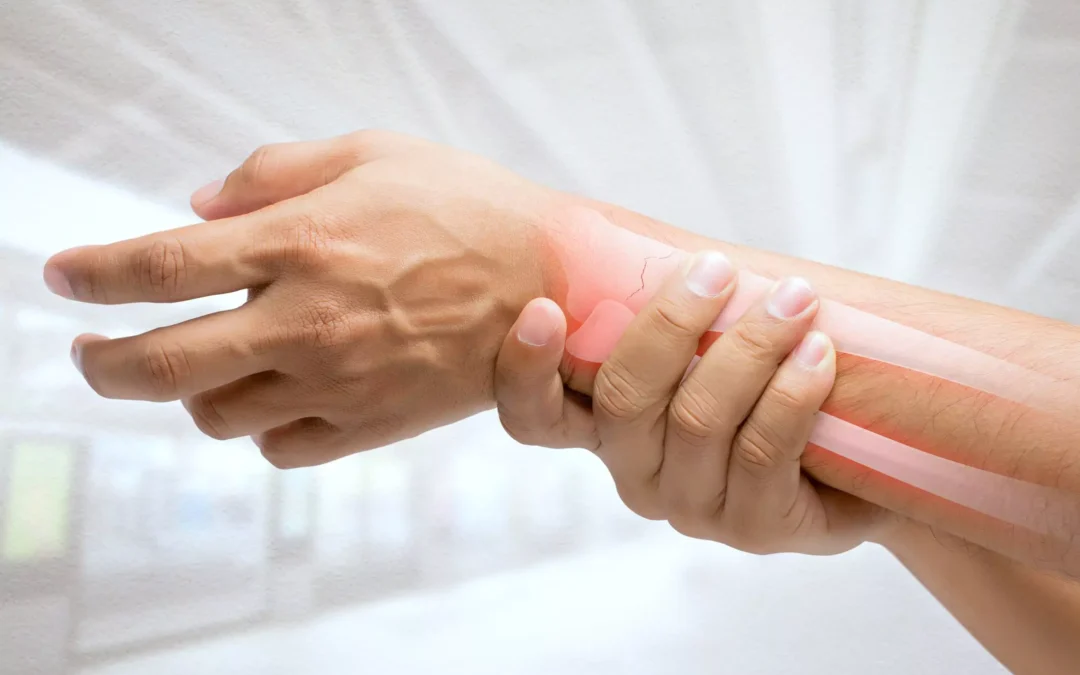 When to begin physiotherapy after a bone fracture