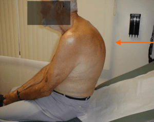 corrective_posture_img