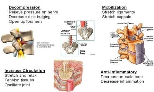 spinal_right_img